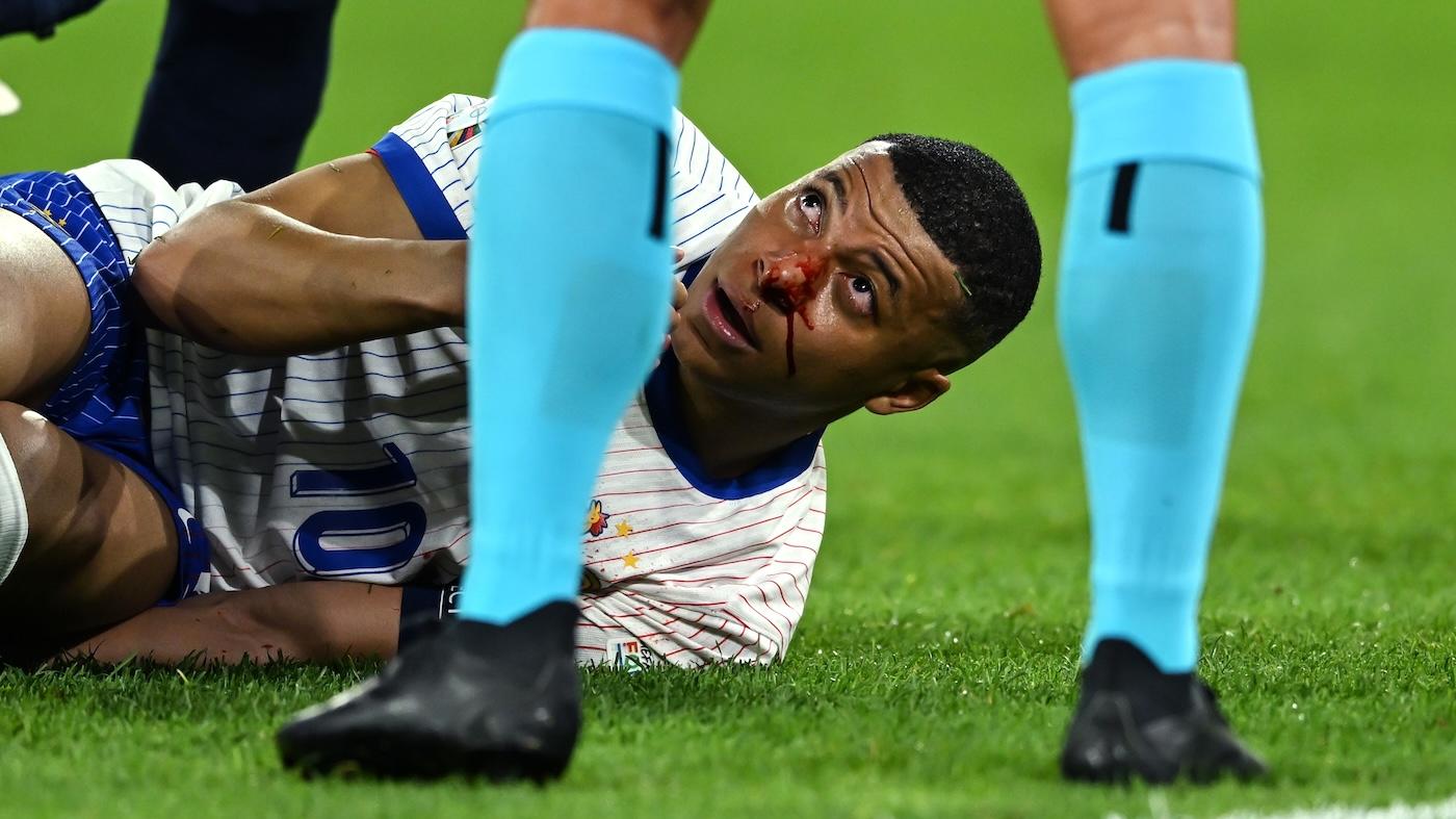 Kylian Mbappe injury: French star undergoes surgery, status vs Netherlands, will he wear a mask?
